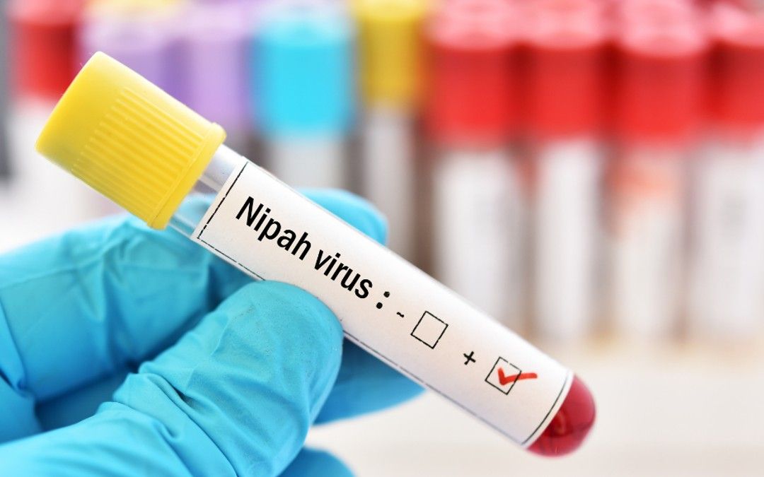 Nipah Virus: 6 Preventive Measures, Signs and Symptoms