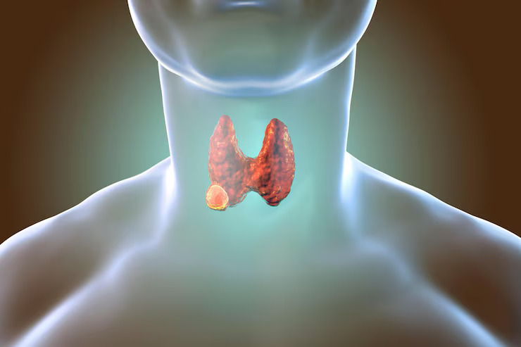 Thyroid