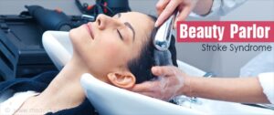 Beauty parlor stroke syndrome