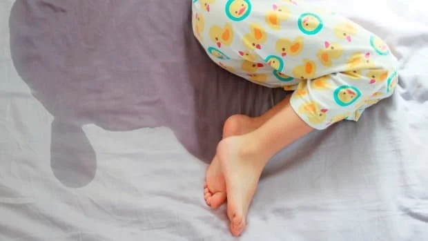 How To Help Your Child Stop Bed-wetting