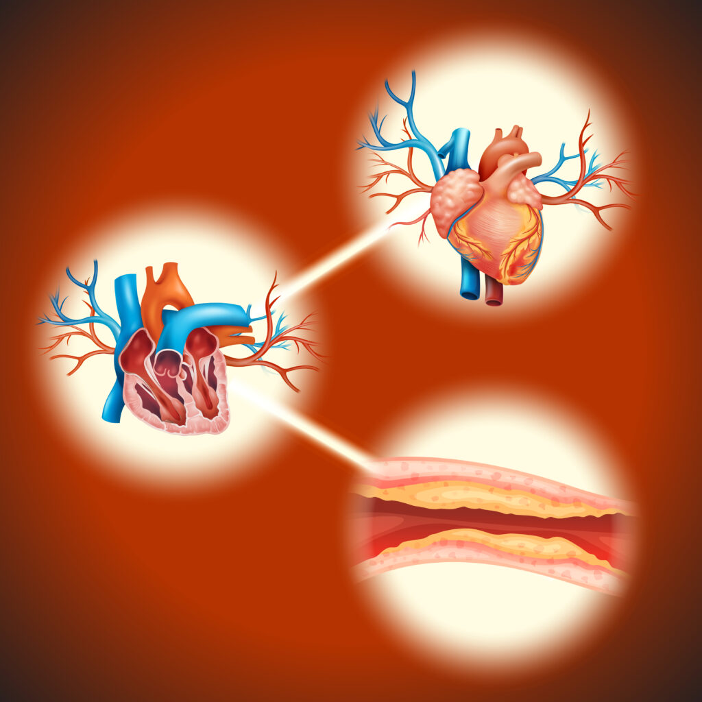 Symptoms of heart disease