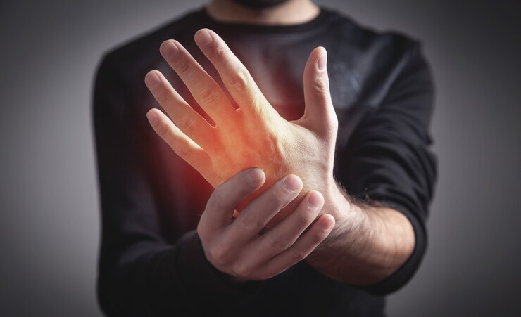 What is Rheumatoid arthritis?