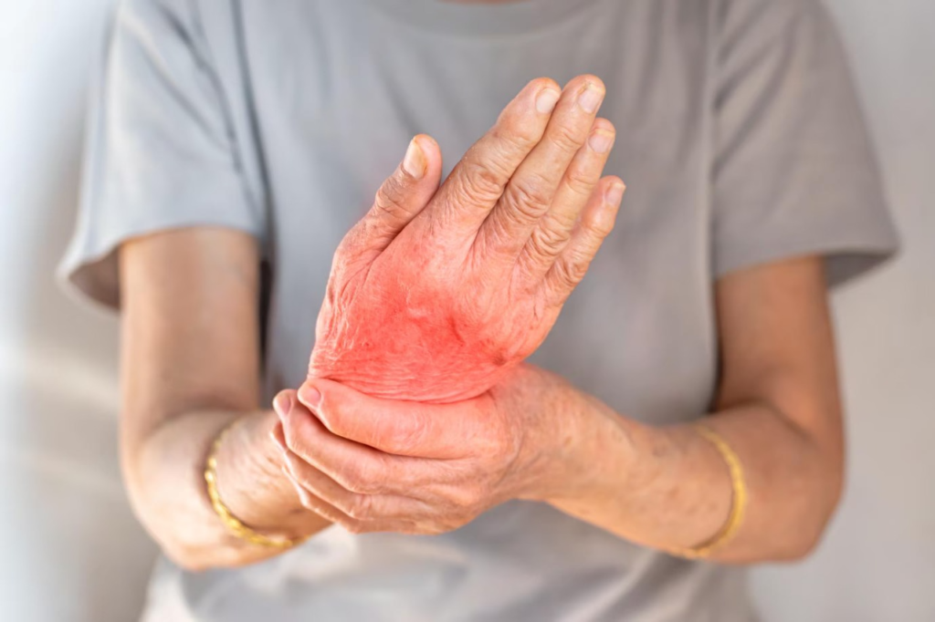 (How to manage Arthritis?)