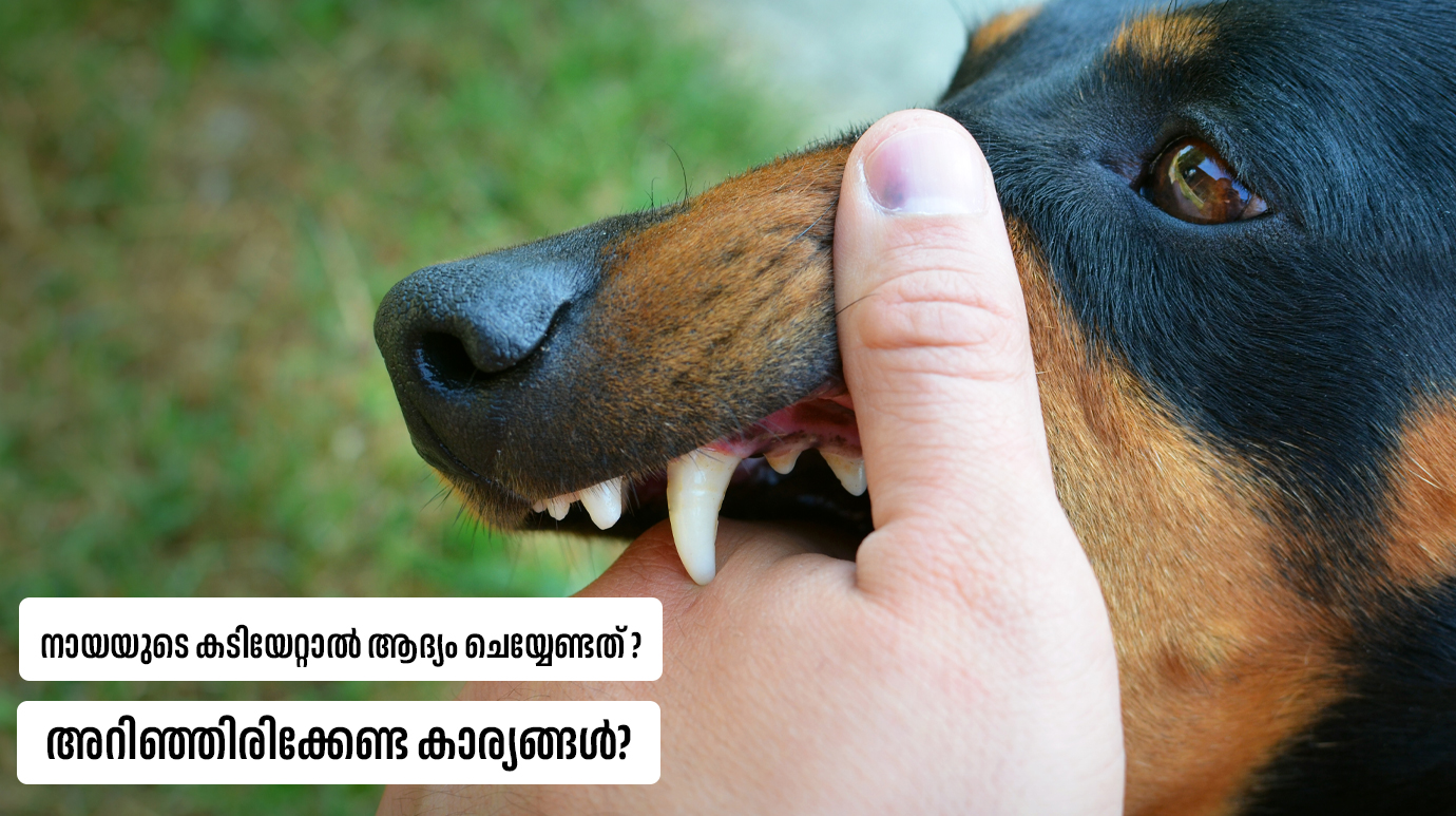 നായയുടെ കടിയേറ്റാല്‍ ആദ്യം ചെയ്യേണ്ടത് എന്ത്? അറിഞ്ഞിരിക്കേണ്ട കാര്യങ്ങള്‍?(What is the first thing to do if you are bitten by a dog?)
