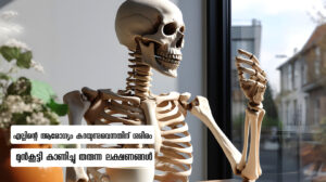 Determinants of Bone Health