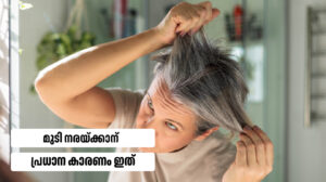 What are reasons for hair loss