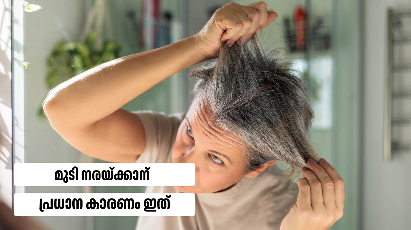 What are reasons for hair loss