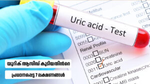 Important 7symptoms of high uric acid