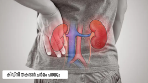 Skin signs of kidney failure