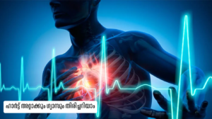 Heart attack gas difference