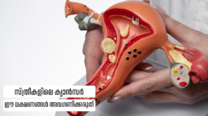 Cancer Symptoms in Women