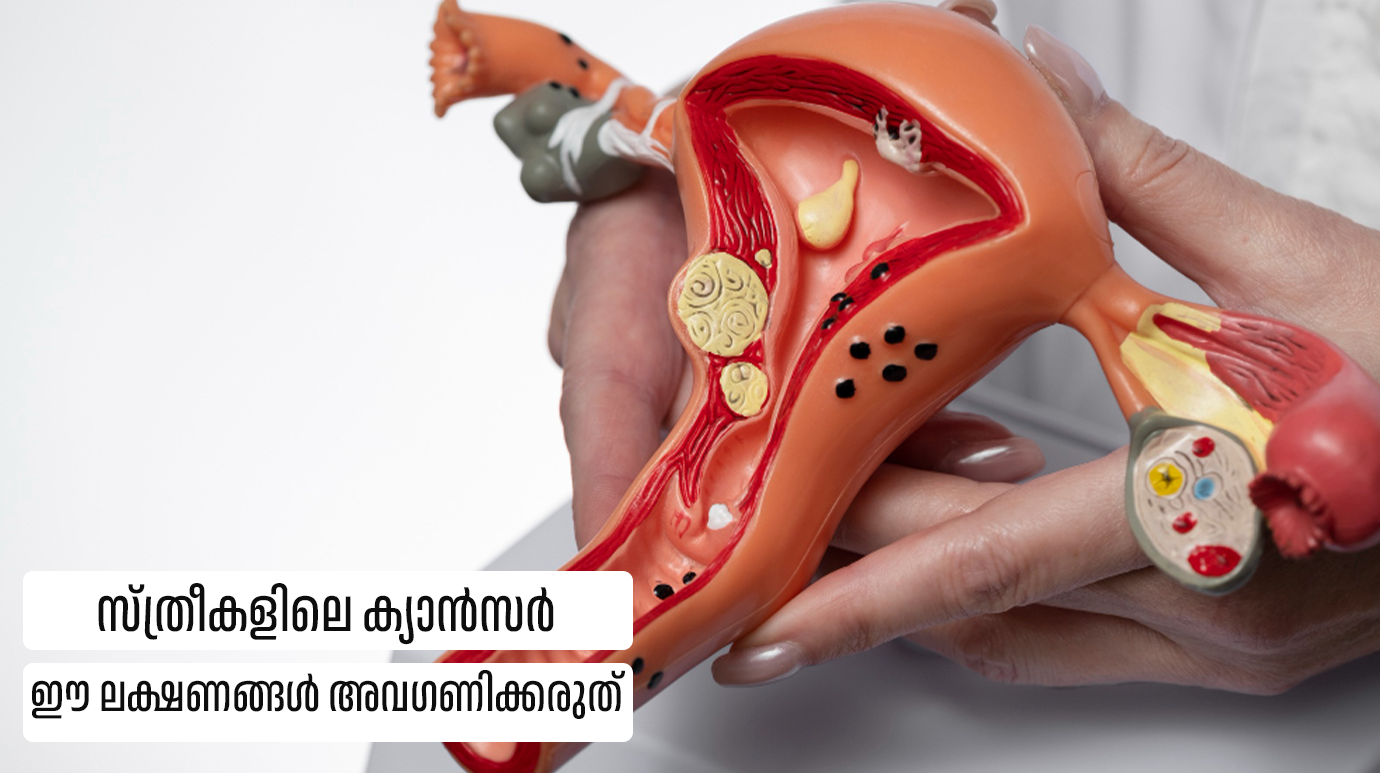 Cancer Symptoms in Women