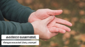 Liver symptoms in hands