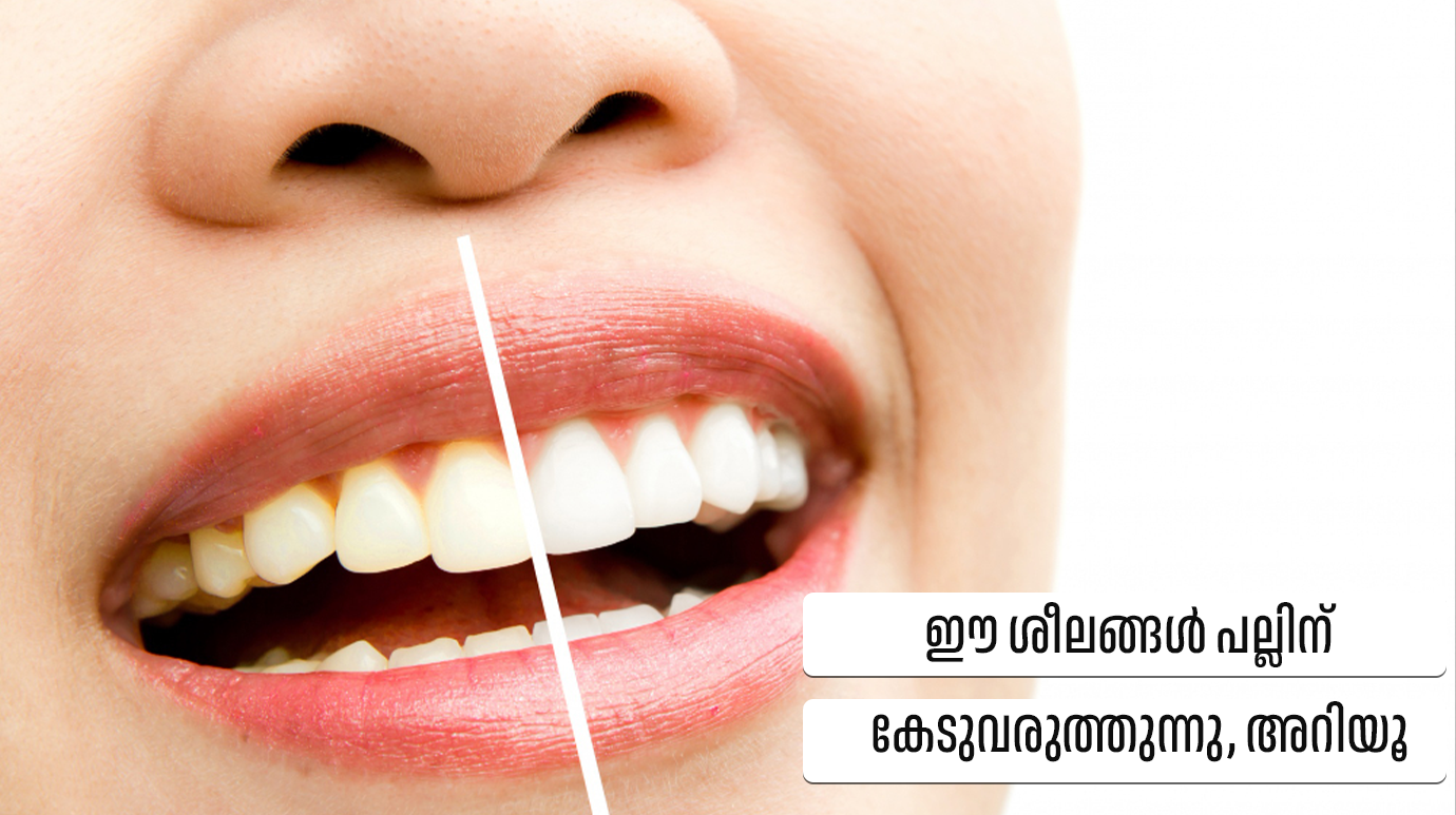 ഈ ശീലങ്ങൾ പല്ലിന് കേടുവരുത്തുന്നു, അറിയൂ(Habits that damage teeth)