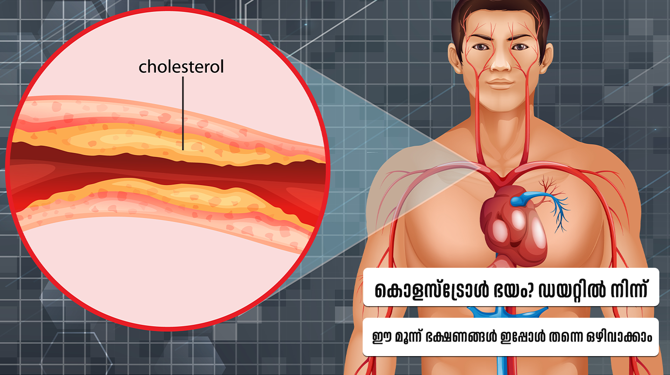 Worst foods for cholesterol