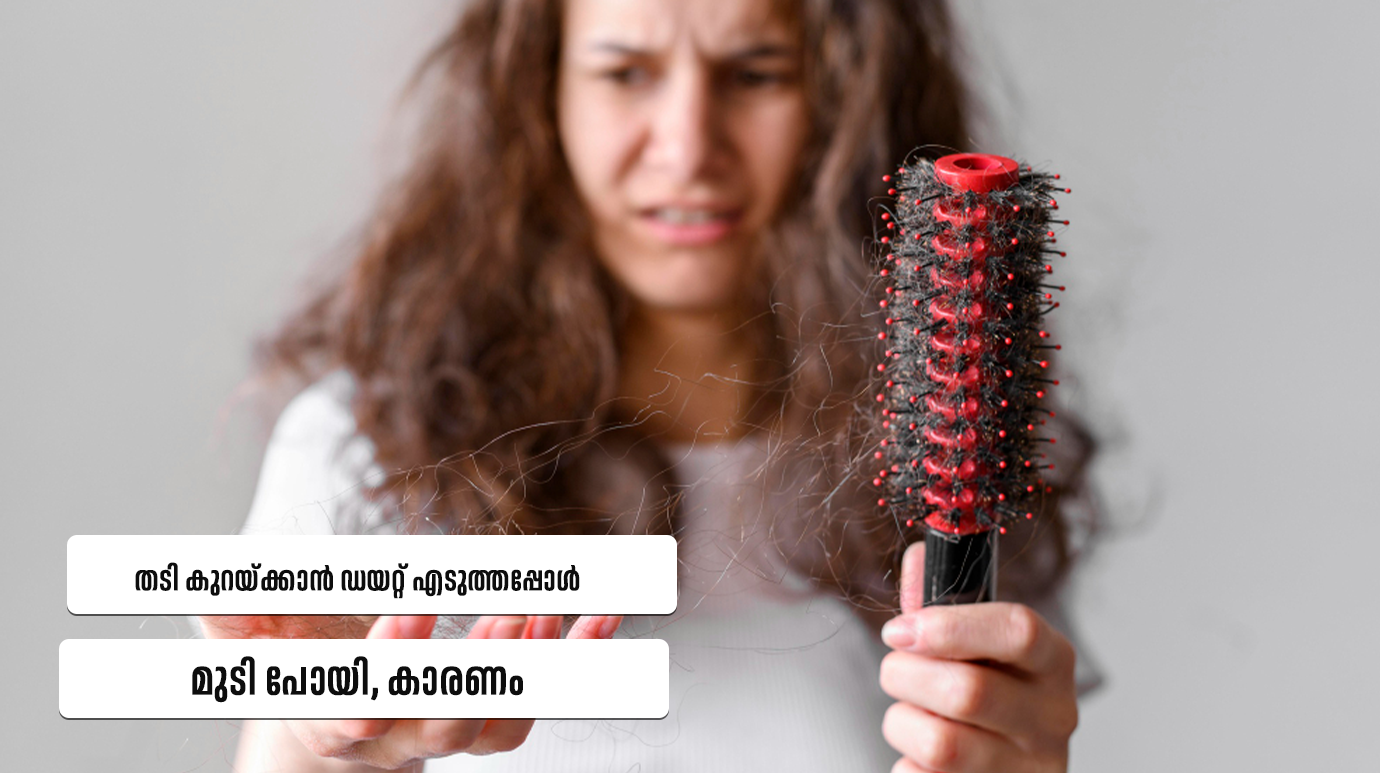 Hair fall during weight loss