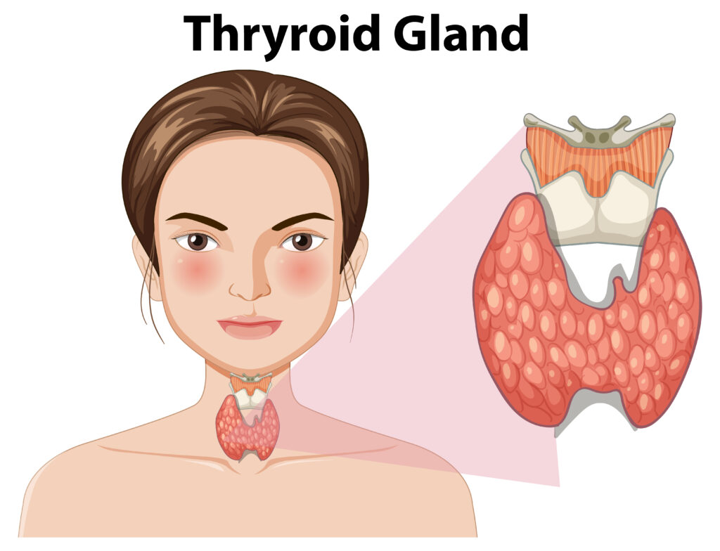 Blood Cancer Symptoms