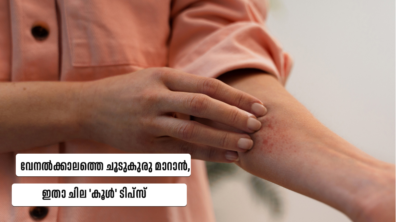 Summer Heat Rash Remedies