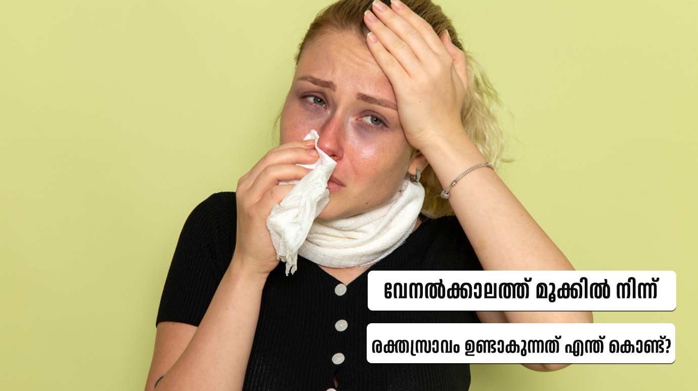 Causes of nosebleeds in summer