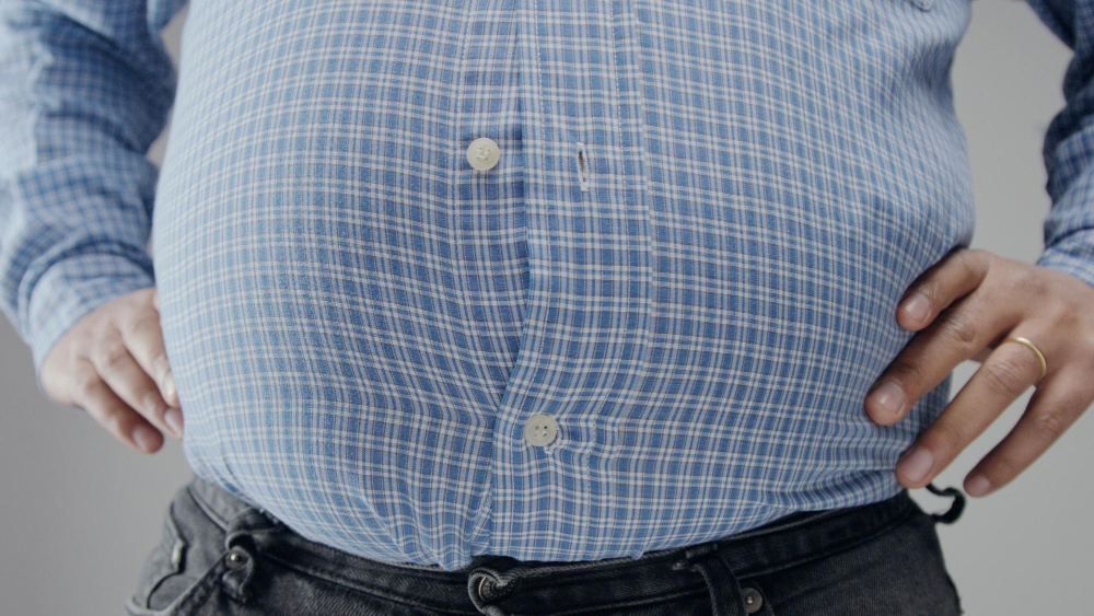Liver Cancer Risk in Obese Men