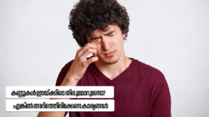 Rubbing eyes frequently?