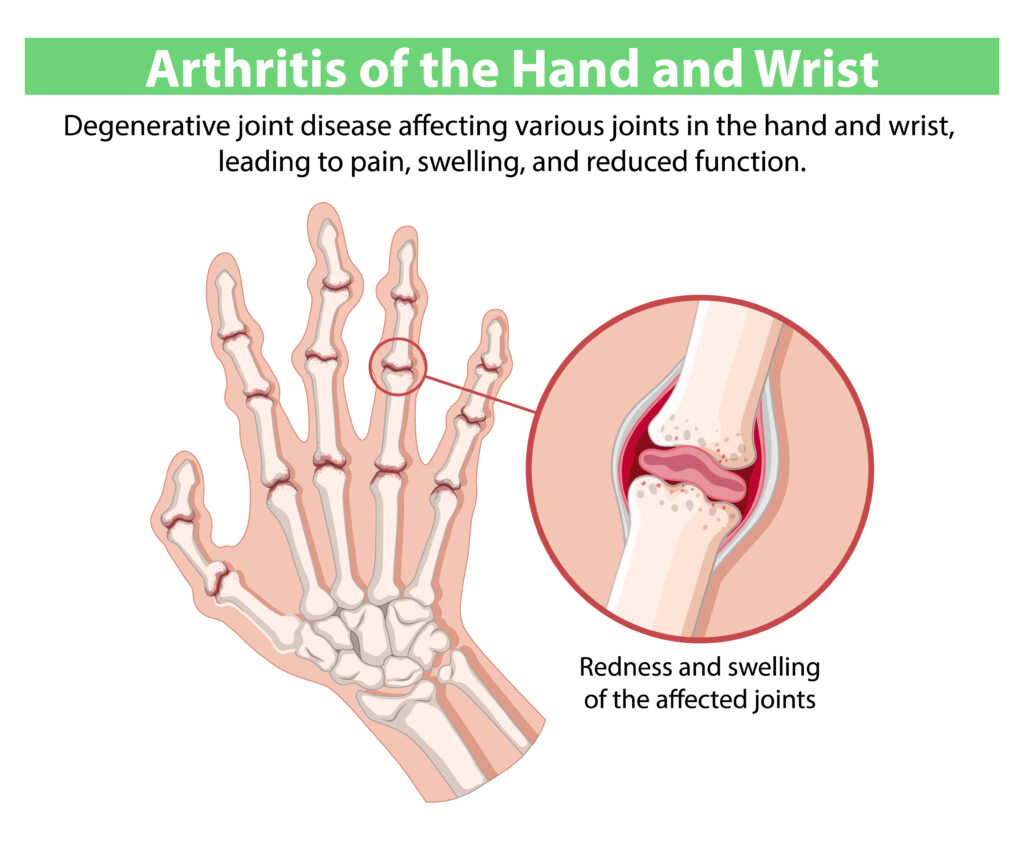 Causes of Morning Leg Pain
