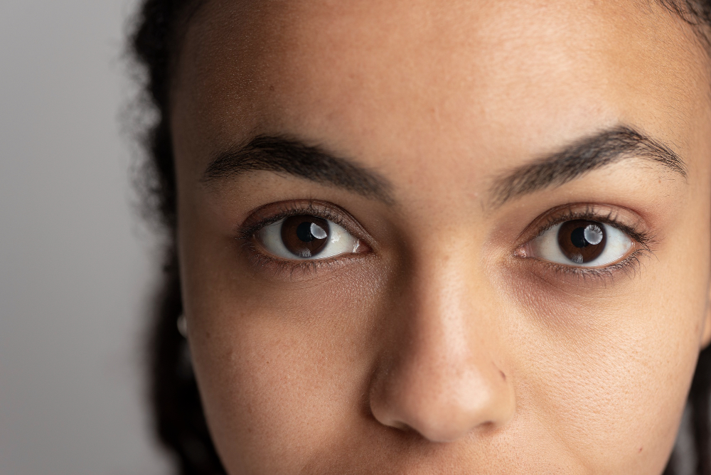 Dark Circles Under Eyes Causes