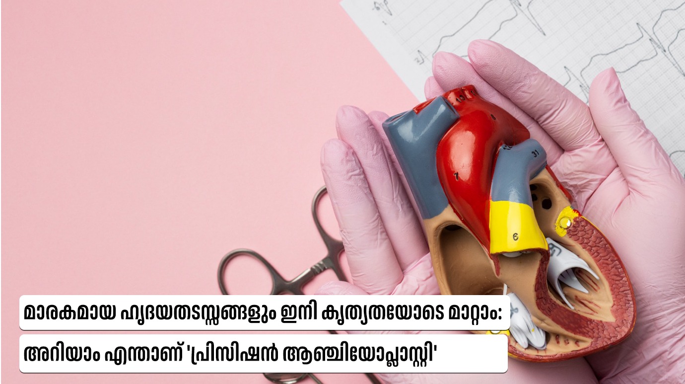 เดฎเดพเดฐเดเดฎเดพเดฏ เดนเตเดฆเดฏเดคเดเดธเตเดธเดเตเดเดณเตเด เดเดจเดฟ เดเตเดคเตเดฏเดคเดฏเตเดเต เดฎเดพเดฑเตเดฑเดพเด: เด
เดฑเดฟเดฏเดพเด เดเดจเตเดคเดพเดฃเต ‘เดชเตเดฐเดฟเดธเดฟเดทเตป เดเดเตเดเดฟเดฏเตเดชเตเดฒเดพเดธเตเดฑเตเดฑเดฟ'(Precision Angioplasty for Complex Heart Blockages)