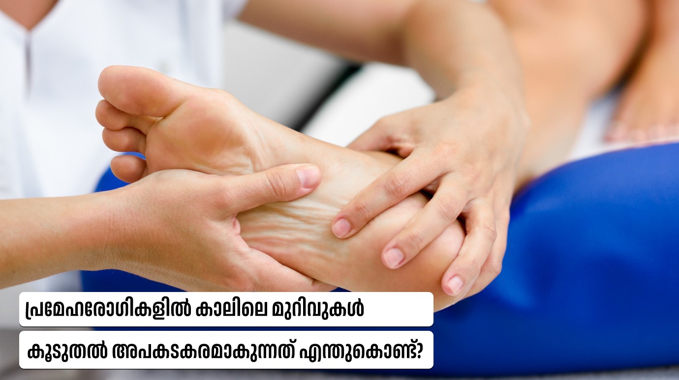 പ്രമേഹരോ​ഗികളിൽ കാലിലെ മുറിവുകൾ കൂടുതൽ അപകടകരമാകുന്നത് എന്തുകൊണ്ട്?(Diabetic Foot Complications)